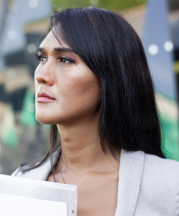 South Bay Transgender Aesthetics model wearing a white jacket
